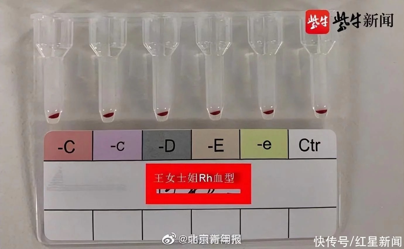 江苏发现2例全球罕见黄金血型